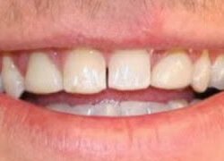 An example of the difference Central Point cosmetic dentistry can make