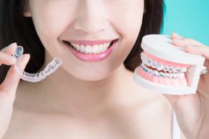 Clear braces alternative (invisalign) vs braces